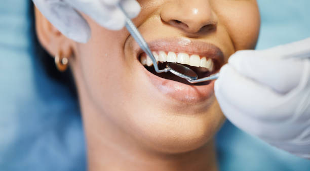 Best Emergency Dentist for Lost Fillings or Crowns in Riverside, IA